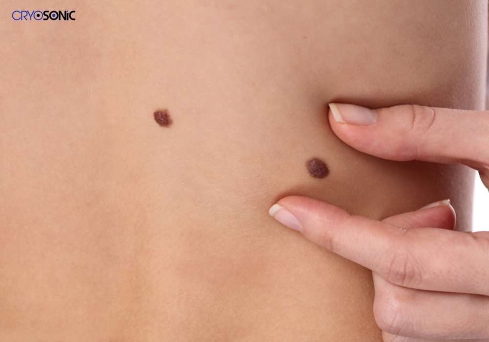 Infection Risk and Poor Aftercare Sutton-Coldfield