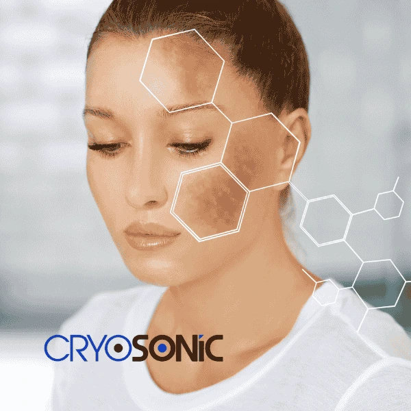 Are you looking for age spot removal treatment? Contact Cryosonic today in Sutton-Coldfield