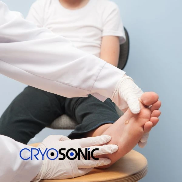 Are you looking for fast effective wart removal Contact us today Sutton-Coldfield