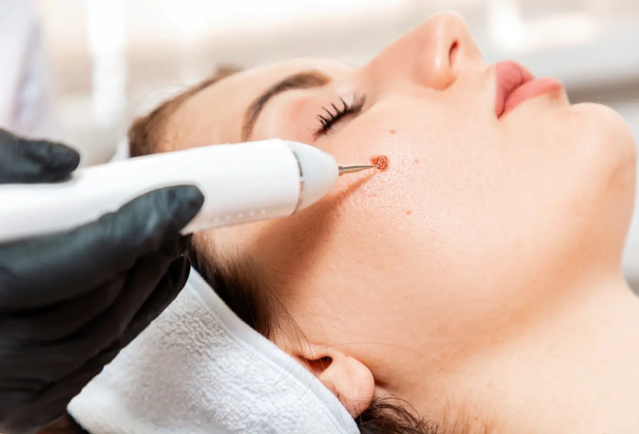 Frequently Asked Questions About Multiple Cryotherapy Treatments Sutton-Coldfield