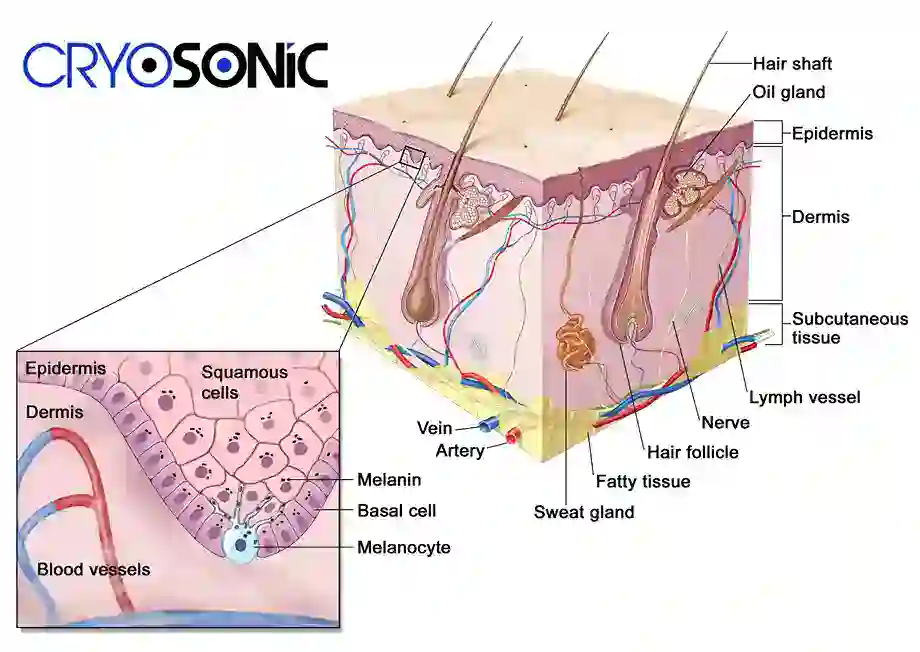 How Cryotherapy Stimulates Melanocyte Activity Sutton-Coldfield